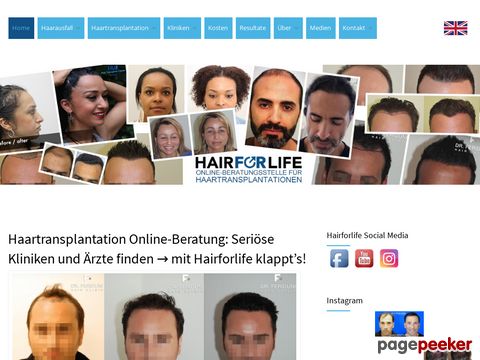 eigenhaarverpflanzung.ch - Alopezie Infos